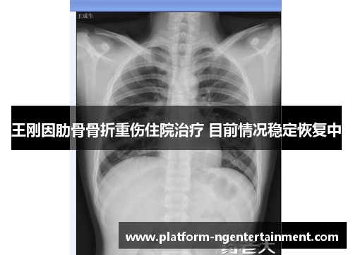 王刚因肋骨骨折重伤住院治疗 目前情况稳定恢复中